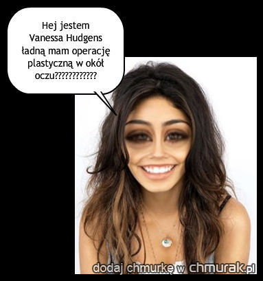 Vanessa Hudgens po nieudanej operacij plastycznej